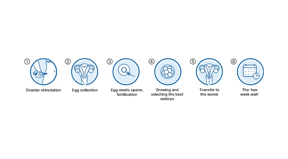 ivf patient journey